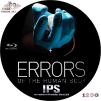 iPS　イントリュージョン・オブ・プレデター・ステムセル